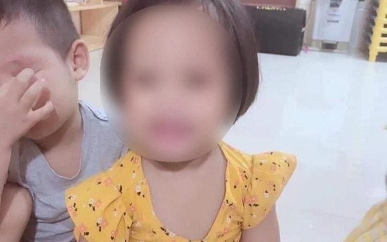 Diễn biến mới về sức khỏe của bé gái 3 tuổi bị ghim đinh vào đầu