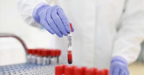 Số ca mắc giảm rất mạnh, Hà Nội tập trung phát hiện sớm biến thể SARS-CoV-2 mới có thể xâm nhập, lây lan