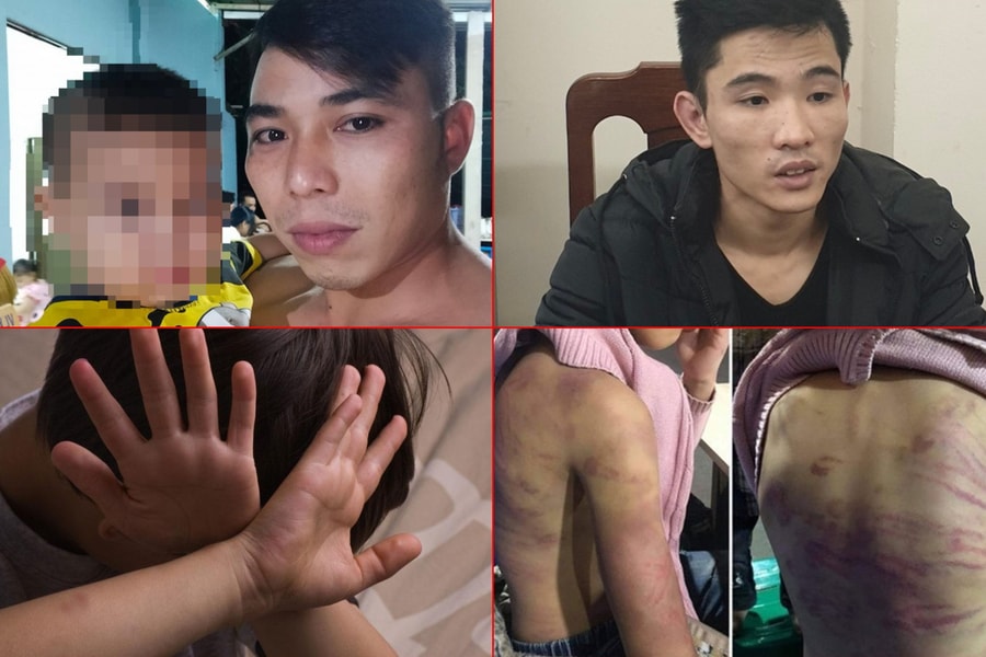 Những vụ cha dượng bạo hành con riêng của vợ gây chấn động dư luận gần đây