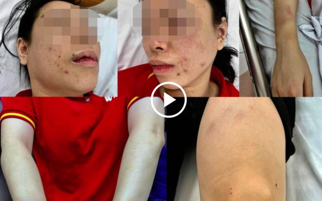 Nghi án người phụ nữ bị chồng cũ đánh đập, dã man