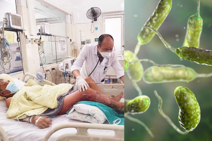 Vi khuẩn Vibrio vulnificus khiến người đàn ông hoại tử chân nguy hiểm thế nào và cách phòng tránh