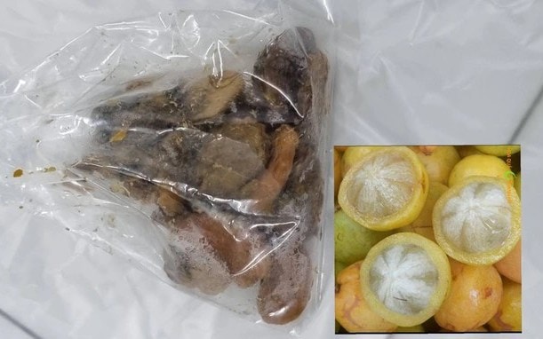 Một người phụ nữ bị thủng ruột do ăn măng cụt rừng không bỏ hạt