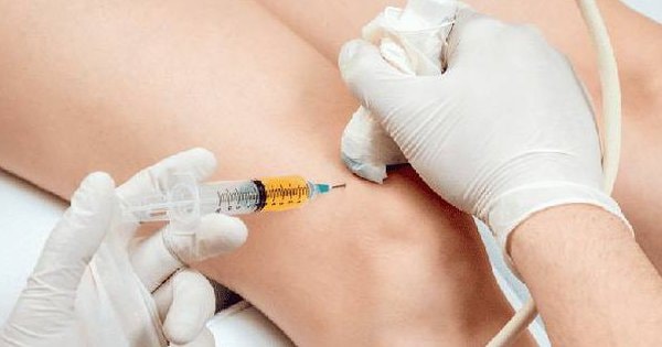 Viêm khớp - Những hiểm họa sau tiêm thuốc vào khớp