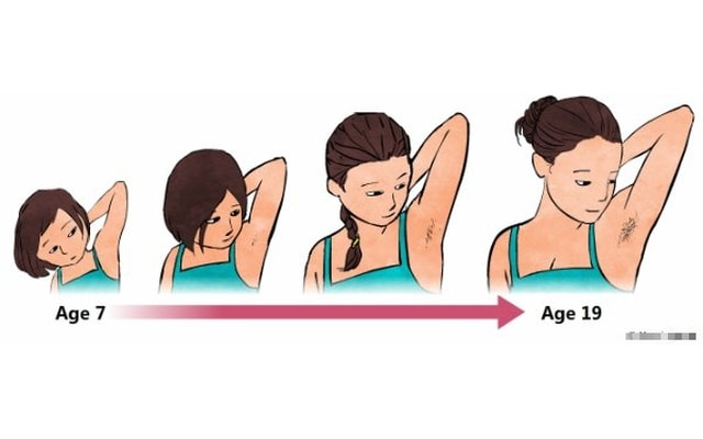 Dậy thì sớm gia tăng, phương pháp nào để điều trị?