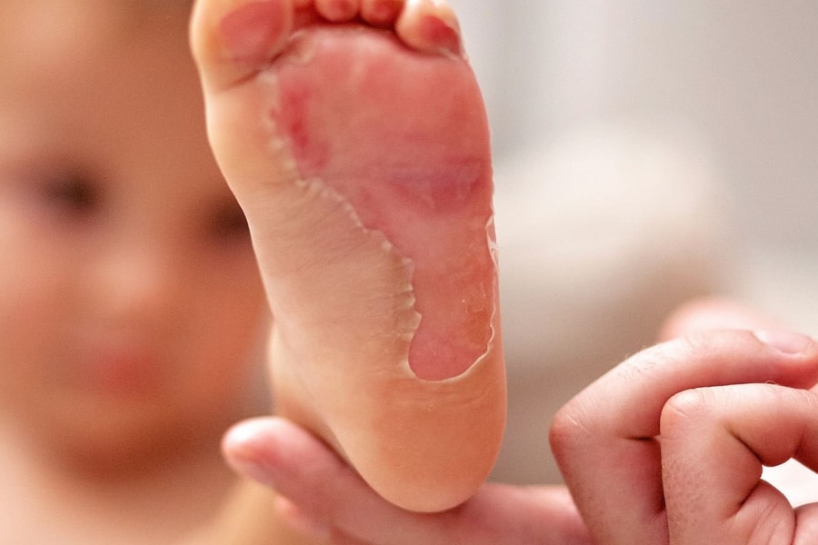 Cách phòng tránh bỏng hóa chất cho trẻ