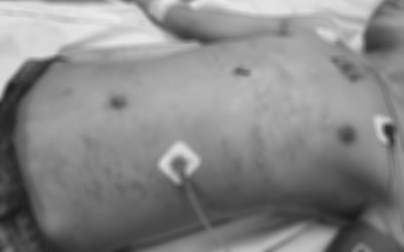 Cứu sống thiếu niên bị bạn đâm thấu bụng trong đêm