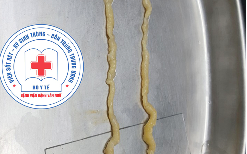 Nhiễm sán dây do thói quen ăn thịt bò tái, rau sống