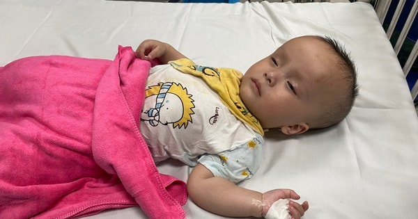 Bé 3 tuổi bị não úng thủy phải nhập điều trị tiếp