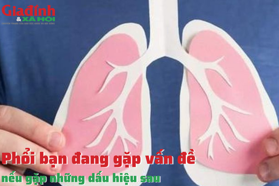 Phổi bạn đang gặp vấn đề nếu có những dấu hiệu sau