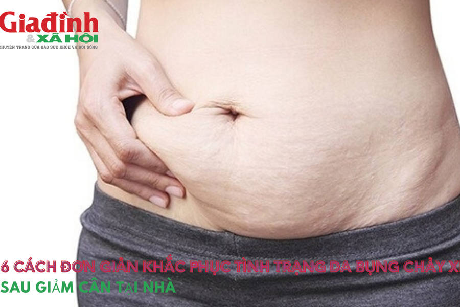 6 cách đơn giản khắc phục tình trạng da bụng chảy xệ sau giảm cân tại nhà