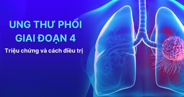 U phổi là gì? Triệu chứng và cách cải thiện