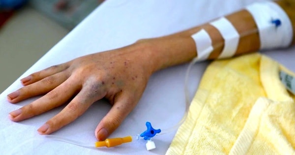 Nghĩ mình khỏe, cô gái 27 mắc ung thư giai đoạn 3 vì bỏ qua dấu hiệu này