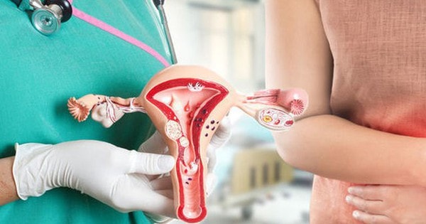 Người phụ nữ bị ung thư phải cắt bỏ cơ quan sinh dục vì xấu hổ không đi khám phụ khoa