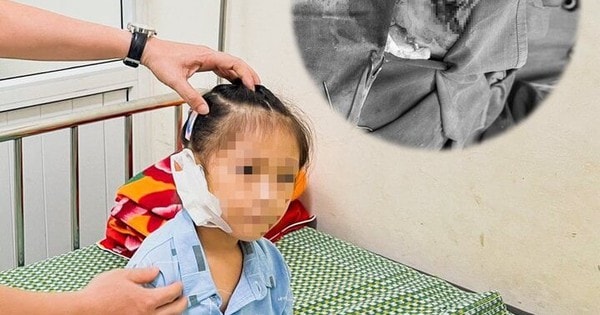 Đang chơi đùa, bé gái 6 tuổi bị đứt tai vì kính vỡ