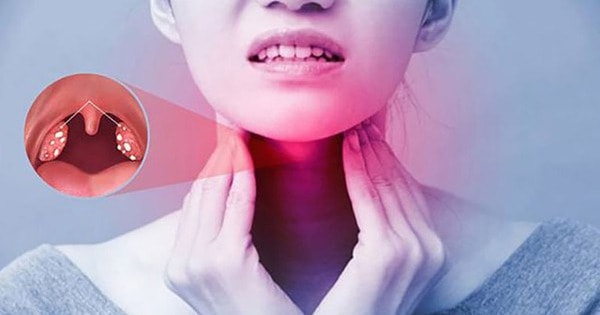 Những biến chứng của viêm họng cấp tính mùa lạnh