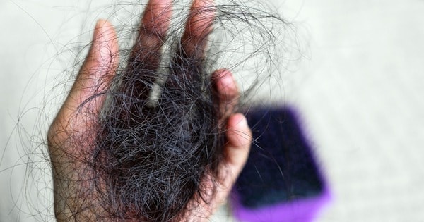 4 thói quen ăn uống khiến tóc rụng nhiều