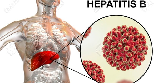 Đau bụng, người đàn ông 38 tuổi đi khám phát hiện có khối u gan 'khủng', đây có thể là nguyên nhân