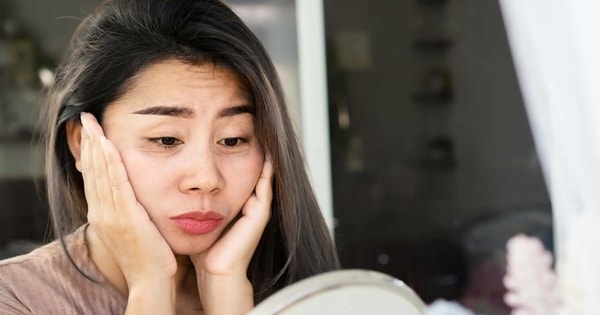 Ba loại quầng thâm và 4 'thuốc' đặc trị mắt gấu trúc