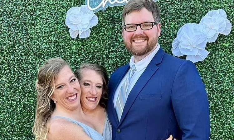 Cô gái trong cặp song sinh dính liền đã kết hôn