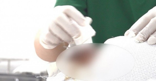 4 công nhân điện lực ở TPHCM bị bỏng nặng khi sửa điện