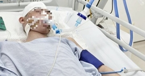 Nam sinh bị đánh chấn thương sọ não được chuyển về Hà Nội: BS cập nhật tình hình mới nhất