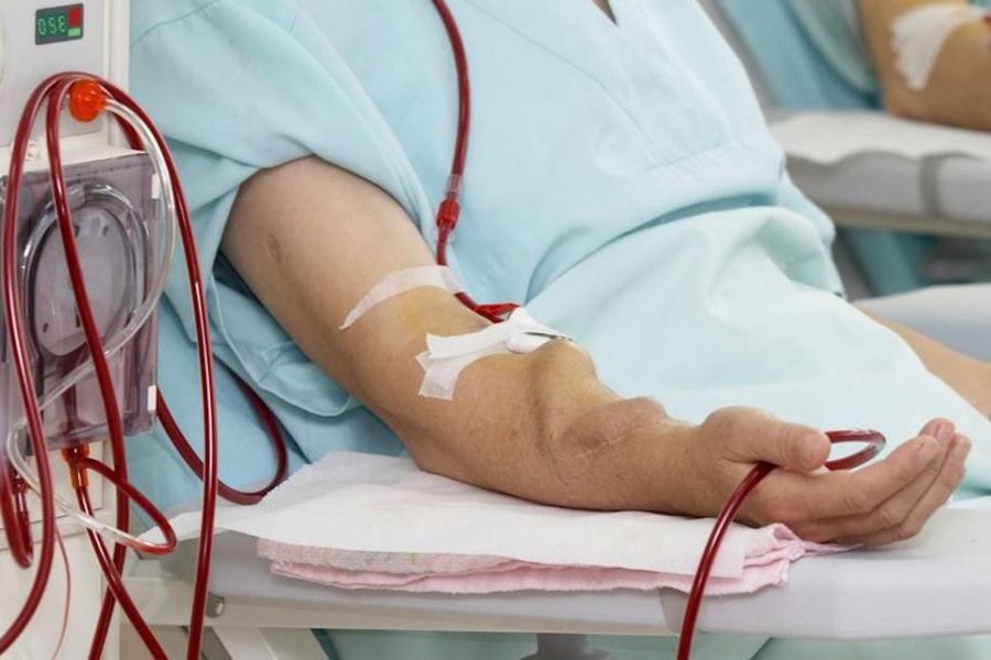 Suy thận ở tuổi 22