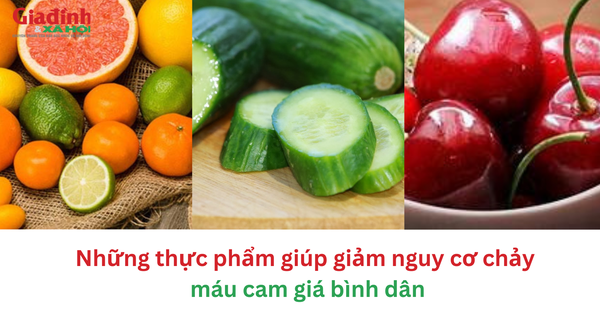 Những thực phẩm giúp giảm nguy cơ chảy máu cam giá bình dân