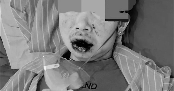 Mua thuốc trên mạng, người phụ nữ 66 tuổi ở Nghệ An tiền mất tật mang