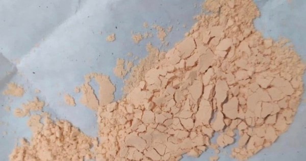 Bé trai 2 tuổi phải lọc máu liên tục sau 7 ngày được người lớn vệ sinh lưỡi