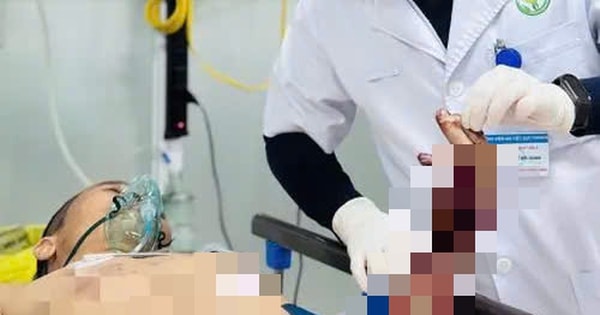 Người đàn ông ở Tuyên Quang phải cắt cụt chi do nổ bình gas khi đang nấu ăn