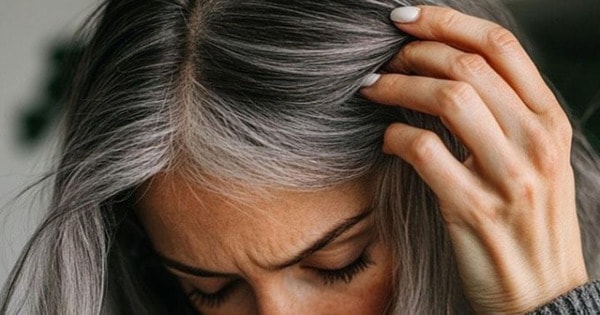 Tóc bạc sớm là do thiếu chất? Bổ sung ngay 3 món ăn vặt dưới đây giúp làm chậm tốc độ bạc tóc