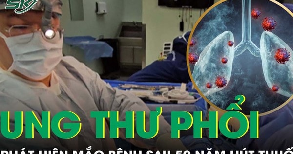 Phát hiện mắc ung thư phổi sau 50 năm hút thuốc lào