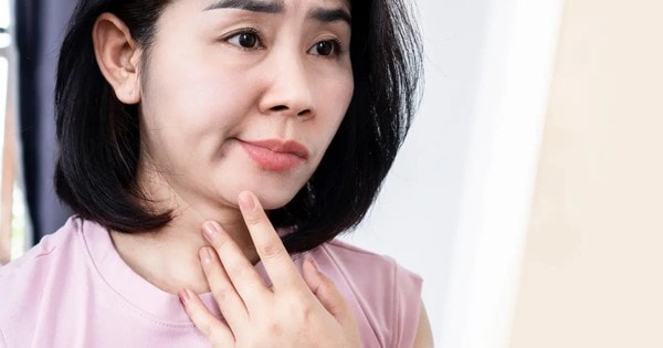 Chế độ dinh dưỡng chăm sóc người bị liệt mặt