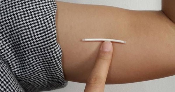 Cấy que tránh thai bao lâu thì có tác dụng?