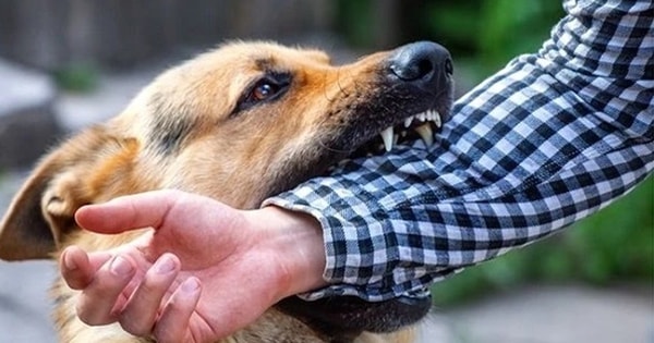 Bé trai 13 tuổi nguy kịch sau 2 tháng bị chó cắn vì việc làm này của người thân