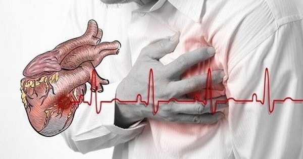 Các yếu tố nguy cơ gây nhồi máu cơ tim