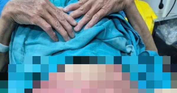 Tự điều trị viêm 'vùng kín', người phụ nữ ở Lạng Sơn bỏng nặng, lở loét toàn bộ vùng sinh dục