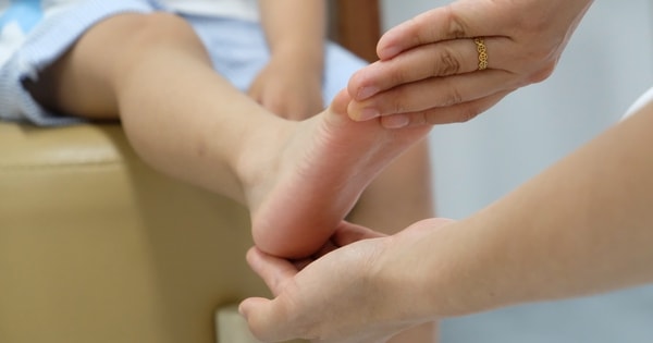 Sưng đau cổ chân phải sau khi chơi bóng rổ, tái phát nhiều lần, bé trai 11 tuổi được phát hiện có bàn chân bẹt hai bên