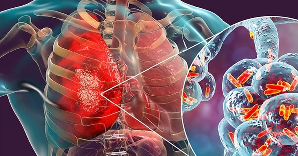 Bé 11 tuổi bất ngờ phát hiện ung thư phổi, nguyên nhân từ một sai lầm mà nhiều nam giới Việt mắc phải