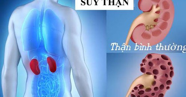 7 việc nên làm để phòng nguy cơ suy thận