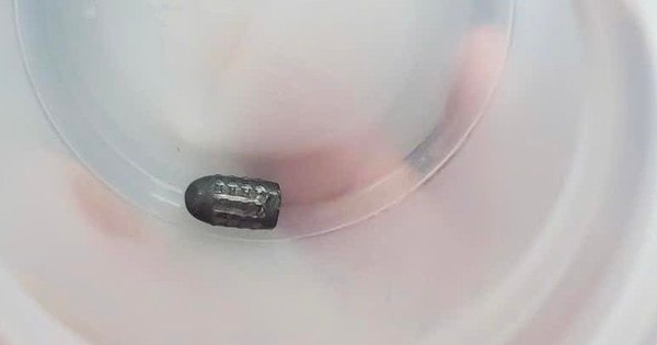 Đã tìm được đối tượng dùng súng hơi bắn chim khiến đạn lạc trúng đầu người phụ nữ đang làm vườn