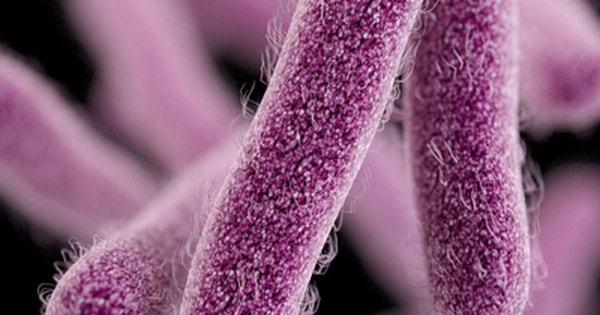 Pháp thu hồi phô mai mềm sau 2 ca tử vong nghi nhiễm khuẩn listeria