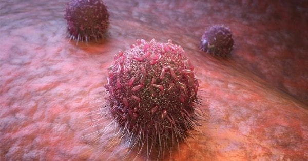 Công nghệ mới giúp đưa thuốc nhắm chính xác vào tế bào ung thư