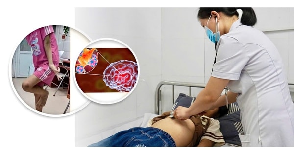 Cứu sống bé gái 12 tuổi bị viêm não tự miễn
