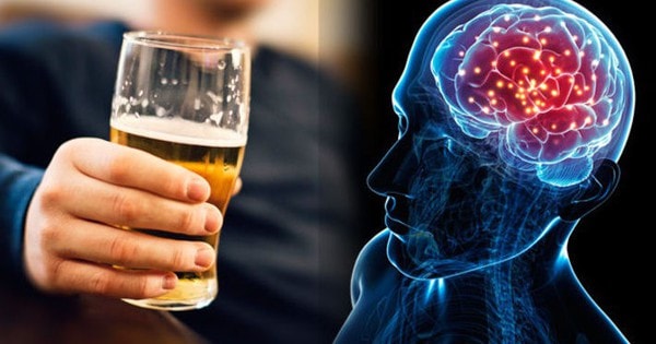 Uống mấy ly rượu mỗi ngày có thể tăng nguy cơ đột quỵ nghiêm trọng?