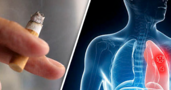 9 ca ung thư phổi đầu tiên từ nghiên cứu mới ở Singapore đều là người không hút thuốc