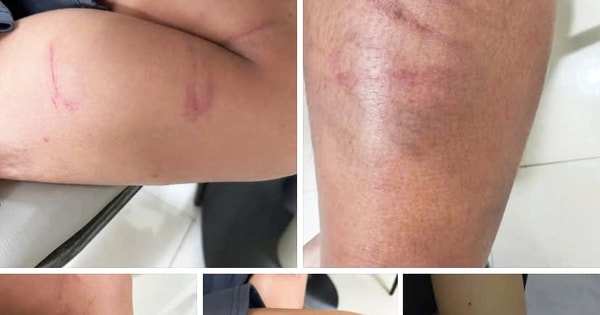 Xác minh clip người đàn ông hành hung 3 bé trai giữa đường