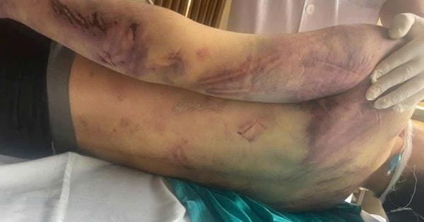 Diễn biến mới vụ học viên tử vong sau 2 ngày nhập học