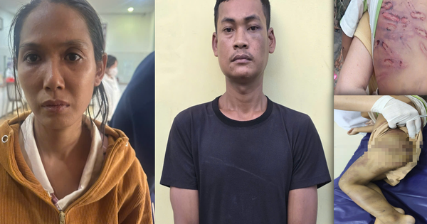 Bắt khẩn cấp mẹ ruột và 'cha dượng' bạo hành bé trai 2 tuổi tại TPHCM