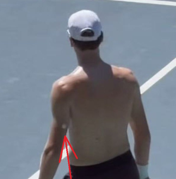 Jannik Sinner dùng cảm biến đường huyết giải bài toán thể lực trước thềm Wimbledon 2026